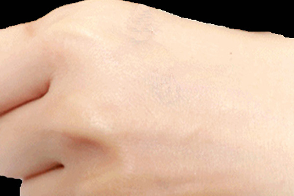 便攜式小口徑色差儀用于皮膚顏色的測量