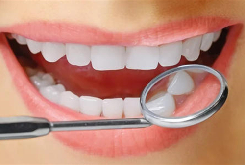 牙齒美白效果