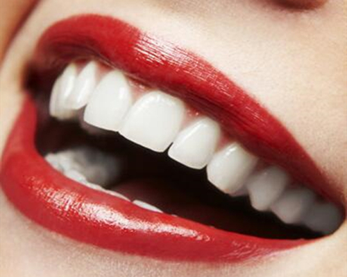 天然牙與修復(fù)體的色差